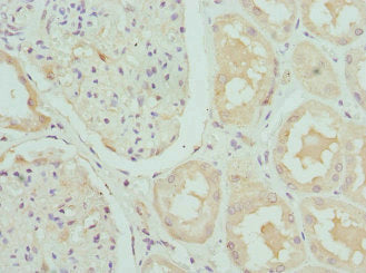 Immunohistochemistry of paraffin-embedded human kidney tissue using CRTAP Antibody at dilution of 1:100Rabbit anti-Human CRTAP Polyclonal Antibody