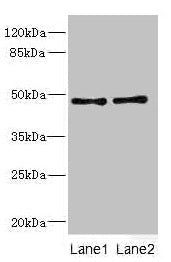 Western blot  | All lanes: CRTAP antibody at 0.96µg/ml  | Lane 1: 293T whole cell lysate  | Lane 2: Hela whole cell lysate  | Secondary  | Goat polyclonal to rabbit IgG at 1/10000 dilution  | Predicted band size: 47 kDa  | Observed band size: 47 kDaRabbit anti-Human CRTAP Polyclonal Antibody