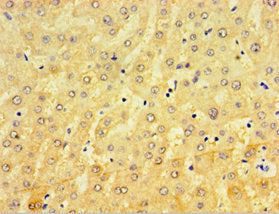 Immunohistochemistry of paraffin-embedded human liver tissue using CRX Antibody at dilution of 1:100Rabbit anti-Human CRX Polyclonal Antibody