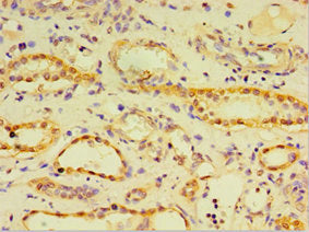 Immunohistochemistry of paraffin-embedded human kidney tissue using CRX Antibody at dilution of 1:100Rabbit anti-Human CRX Polyclonal Antibody