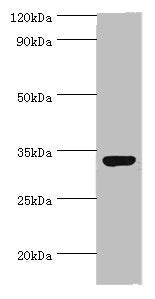 Western blot | All lanes: CRX antibody at 2μg/ml + 293T whole cell lysate | Secondary | Goat polyclonal to rabbit IgG at 1/10000 dilution | Predicted band size: 32 kDa | Observed band size: 32 kDaRabbit anti-Human CRX Polyclonal Antibody