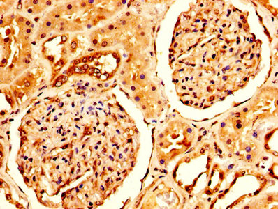 IHC image of CRYAB Antibody diluted at 1:200 and staining in paraffin-embedded human kidney tissue performed on a Leica BondTM system. After dewaxing and hydration, antigen retrieval was mediated by high pressure in a citrate buffer (pH 6.0). Section was blocked with 10% normal goat serum 30min at RT. Then primary antibody (1% BSA) was incubated at 4°C overnight. The primary is detected by a biotinylated secondary antibody and visualized using an HRP conjugated SP system.Rabbit anti-Human CRYAB Polyclonal Antibody