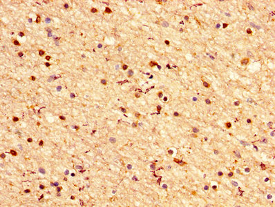 IHC image of CRYAB Antibody diluted at 1:200 and staining in paraffin-embedded human brain tissue performed on a Leica BondTM system. After dewaxing and hydration, antigen retrieval was mediated by high pressure in a citrate buffer (pH 6.0). Section was blocked with 10% normal goat serum 30min at RT. Then primary antibody (1% BSA) was incubated at 4°C overnight. The primary is detected by a biotinylated secondary antibody and visualized using an HRP conjugated SP system.Rabbit anti-Human CRYAB Polyclonal Antibody