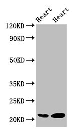 Western Blot  | Positive WB detected in: Rat heart tissue, Mouse heart tissue  | All lanes: CRYAB antibody at 2µg/ml  | Secondary  | Goat polyclonal to rabbit IgG at 1/50000 dilution  | Predicted band size: 21 kDa  | Observed band size: 21 kDaRabbit anti-Human CRYAB Polyclonal Antibody