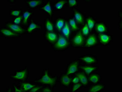 Immunofluorescence staining of A549 cells with the antibody at 1:100, counter-stained with DAPI. The cells were fixed in 4% formaldehyde, permeabilized using 0.2% Triton X-100 and blocked in 10% normal Goat Serum. The cells were then incubated with the antibody overnight at 4°C. The secondary antibody was Alexa Fluor 488-congugated AffiniPure Goat Anti-Rabbit IgG(H+L).Rabbit anti-Human CRYBA1 Polyclonal Antibody