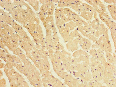 Immunohistochemistry of paraffin-embedded human heart tissue using CRYBA1 Antibody at dilution of 1:100Rabbit anti-Human CRYBA1 Polyclonal Antibody