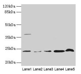 Western blot  | All lanes: CRYBA1 antibody at 6µg/ml  | Lane 1: Human placenta tissue  | Lane 2: U251 whole cell lysate  | Lane 3: U937 whole cell lysate  | Lane 4: Mouse stomach tissue  | Lane 5: Mouse liver tissue  | Secondary  | Goat polyclonal to rabbit IgG at 1/10000 dilution  | Predicted band size: 26, 24 kDa  | Observed band size: 24 kDaRabbit anti-Human CRYBA1 Polyclonal Antibody
