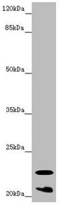 Western blot | All lanes: CRYGS antibody at 6.87 μg/ml + Mouse eye tissue | Secondary | Goat polyclonal to rabbit IgG at 1/10000 dilution | Predicted band size: 21 kDa | Observed band size: 21, 23 kDaRabbit anti-Human CRYGS Polyclonal Antibody
