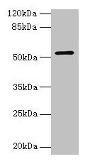 Western blot  | All lanes: CS antibody at 3µg/ml + HepG2 whole cell lysate  | Secondary  | Goat polyclonal to rabbit IgG at 1/10000 dilution  | Predicted band size: 52 kDa  | Observed band size: 52 kDaRabbit anti-Human CS Polyclonal Antibody