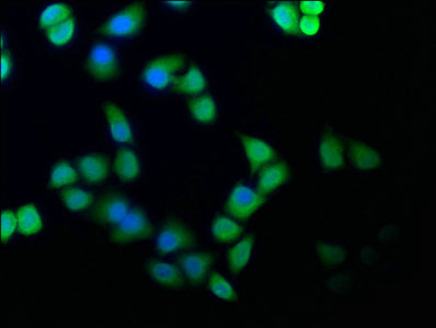 Immunofluorescence staining of Hela cells with CSE1L Antibody at 1:100, counter-stained with DAPI. The cells were fixed in 4% formaldehyde, permeabilized using 0.2% Triton X-100 and blocked in 10% normal Goat Serum. The cells were then incubated with the antibody overnight at 4°C. The secondary antibody was Alexa Fluor 488-congugated AffiniPure Goat Anti-Rabbit IgG(H+L).Rabbit anti-Human CSE1L Polyclonal Antibody