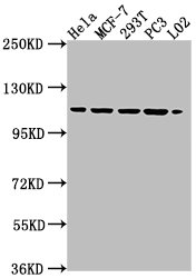 Western Blot | Positive WB detected in: HeLa whole cell lysate, MCF-7 whole cell lysate, 293T whole cell lysate, PC3 whole cell lysate, L02 whole cell lysate | All lanes: CSE1L antibody at 1:2000 | Secondary | Goat polyclonal to rabbit IgG at 1/50000 dilution | Predicted band size: 111, 23, 108, 104 kDa | Observed band size: 111 kDaRabbit anti-Human CSE1L Polyclonal Antibody