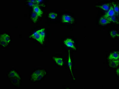 Immunofluorescence staining of HepG2 cells with the antibody at 1:466, counter-stained with DAPI. The cells were fixed in 4% formaldehyde, permeabilized using 0.2% Triton X-100 and blocked in 10% normal Goat Serum. The cells were then incubated with the antibody overnight at 4°C. The secondary antibody was Alexa Fluor 488-congugated AffiniPure Goat Anti-Rabbit IgG(H+L).Rabbit anti-Human CSF2RA Polyclonal Antibody