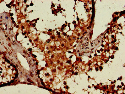 Immunohistochemistry of paraffin-embedded human testis tissue using CSF2RA Antibody at dilution of 1:100Rabbit anti-Human CSF2RA Polyclonal Antibody