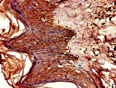 Immunohistochemistry of paraffin-embedded human skin tissue using CSF2RA Antibody at dilution of 1:100Rabbit anti-Human CSF2RA Polyclonal Antibody