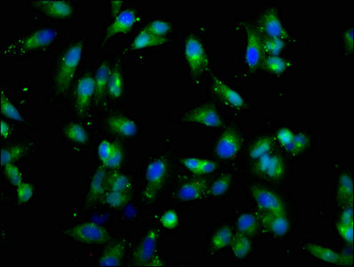 Immunofluorescence staining of Hela cells with CSF2RB Antibody at 1:66, counter-stained with DAPI. The cells were fixed in 4% formaldehyde, permeabilized using 0.2% Triton X-100 and blocked in 10% normal Goat Serum. The cells were then incubated with the antibody overnight at 4°C. The secondary antibody was Alexa Fluor 488-congugated AffiniPure Goat Anti-Rabbit IgG(H+L).Rabbit anti-Human CSF2RB Polyclonal Antibody