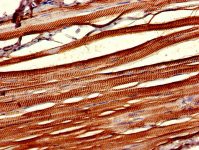 IHC image of CSNK1D Antibody diluted at 1:1000 and staining in paraffin-embedded human skeletal muscle tissue performed on a Leica BondTM system. After dewaxing and hydration, antigen retrieval was mediated by high pressure in a citrate buffer (pH 6.0). Section was blocked with 10% normal goat serum 30min at RT. Then primary antibody (1% BSA) was incubated at 4°C overnight. The primary is detected by a biotinylated secondary antibody and visualized using an HRP conjugated SP system.Rabbit anti-Human CSNK1D Polyclonal Antibody