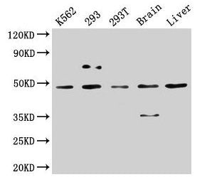 Western Blot  | Positive WB detected in: K562 whole cell lysate, 293 whole cell lysate, 293T whole cell lysate, Rat brain tissue, Mouse liver tissue  | All lanes: CSNK1D antibody at 5µg/ml  | Secondary  | Goat polyclonal to rabbit IgG at 1/50000 dilution  | Predicted band size: 48, 47 kDa  | Observed band size: 48 kDaRabbit anti-Human CSNK1D Polyclonal Antibody
