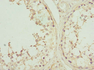 Immunohistochemistry of paraffin-embedded human testis tissue using CSNK1G2 Antibody at dilution of 1:100Rabbit anti-Human CSNK1G2 Polyclonal Antibody
