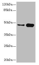 Western blot | All lanes: CSNK1G2 antibody at 4.21μg/ml | Lane 1: Mouse gonadal tissue | Lane 2: Hela whole cell lysate | Secondary | Goat polyclonal to rabbit IgG at 1/10000 dilution | Predicted band size: 47 kDa | Observed band size: 47 kDaRabbit anti-Human CSNK1G2 Polyclonal Antibody