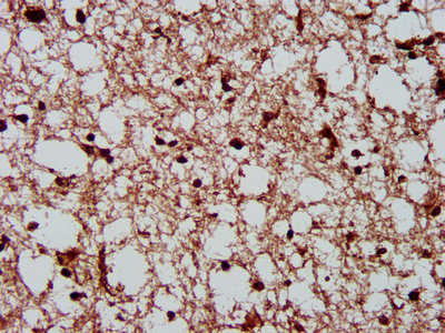 IHC image of CSNK2A1 Antibody diluted at 1:300 and staining in paraffin-embedded human brain tissue performed on a Leica BondTM system. After dewaxing and hydration, antigen retrieval was mediated by high pressure in a citrate buffer (pH 6.0). Section was blocked with 10% normal goat serum 30min at RT. Then primary antibody (1% BSA) was incubated at 4°C overnight. The primary is detected by a biotinylated secondary antibody and visualized using an HRP conjugated SP system.Rabbit anti-Human CSNK2A1 Polyclonal Antibody