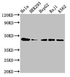 Western Blot  | Positive WB detected in: Hela whole cell lysate, HEK293 whole cell lysate, HepG2 whole cell lysate, Raji whole cell lysate, K562 whole cell lysate  | All lanes: CSNK2A1 antibody at 3µg/ml  | Secondary  | Goat polyclonal to rabbit IgG at 1/50000 dilution  | Predicted band size: 46, 30 kDa  | Observed band size: 46 kDaRabbit anti-Human CSNK2A1 Polyclonal Antibody