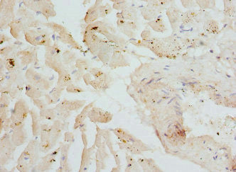 Immunohistochemistry of paraffin-embedded human heart tissue using CSRP3 Antibody at dilution of 1:100