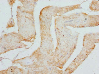 Immunohistochemistry of paraffin-embedded human skeletal muscle tissue using CSRP3 Antibody at dilution of 1:100