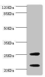 Western blot | All lanes: CSRP3 antibody at 1μg/ml + Mouse skeletal muscle tissue | Secondary | Goat polyclonal to rabbit IgG at 1/10000 dilution | Predicted band size: 21 kDa | Observed band size: 21, 25 kDa