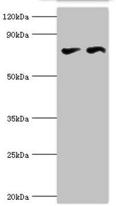 Western blot | All lanes: Transcriptional repressor CTCF antibody at 6μg/ml | Lane 1: PC-3 whole cell lysate | Lane 2: MCF-7 whole cell lysate | Secondary | Goat polyclonal to rabbit IgG at 1/10000 dilution | Predicted band size: 83, 46 kDa | Observed band size: 83 kDaRabbit anti-Human CTCF Polyclonal Antibody
