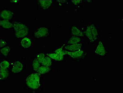 Immunofluorescent analysis of HepG2 cells using CTH Antibody at dilution of 1:100 and Alexa Fluor 488-congugated AffiniPure Goat Anti-Rabbit IgG(H+L)Rabbit anti-Human CTH Polyclonal Antibody