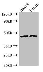 Western Blot | Positive WB detected in: Rat heart tissue, Mouse brain tissue | All lanes: CTH antibody at 4μg/ml | Secondary | Goat polyclonal to rabbit IgG at 1/50000 dilution | Predicted band size: 45, 40, 42 kDa | Observed band size: 45 kDaRabbit anti-Human CTH Polyclonal Antibody