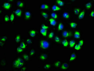 Immunofluorescence staining of Hela cells with CTNNA1 Antibody at 1:333, counter-stained with DAPI. The cells were fixed in 4% formaldehyde, permeabilized using 0.2% Triton X-100 and blocked in 10% normal Goat Serum. The cells were then incubated with the antibody overnight at 4°C. The secondary antibody was Alexa Fluor 488-congugated AffiniPure Goat Anti-Rabbit IgG(H+L).Rabbit anti-Human CTNNA1 Polyclonal Antibody