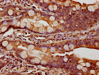 IHC image of CTNNA1 Antibody diluted at 1:1000 and staining in paraffin-embedded human small intestine tissue performed on a Leica BondTM system. After dewaxing and hydration, antigen retrieval was mediated by high pressure in a citrate buffer (pH 6.0). Section was blocked with 10% normal goat serum 30min at RT. Then primary antibody (1% BSA) was incubated at 4°C overnight. The primary is detected by a biotinylated secondary antibody and visualized using an HRP conjugated SP system.Rabbit anti-Human CTNNA1 Polyclonal Antibody