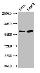 Western Blot  | Positive WB detected in: Hela whole cell lysate, HepG2 whole cell lysate  | All lanes: CTNNA1 antibody at 3.3µg/ml  | Secondary  | Goat polyclonal to rabbit IgG at 1/50000 dilution  | Predicted band size: 101, 103, 60 kDa  | Observed band size: 101 kDaRabbit anti-Human CTNNA1 Polyclonal Antibody