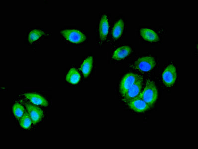 Immunofluorescent analysis of A549 cells using CTNND1 Antibody at dilution of 1:100 and Alexa Fluor 488-congugated AffiniPure Goat Anti-Rabbit IgG(H+L)Rabbit anti-Human CTNND1 Polyclonal Antibody