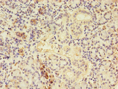 Immunohistochemistry of paraffin-embedded human pancreatic tissue using CTPS1 Antibody at dilution of 1:100Rabbit anti-Human CTPS1 Polyclonal Antibody