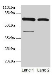 Western blot  | All lanes: CTPS1 antibody at 6µg/ml  | Lane 1: Hela whole cell lysate  | Lane 2: 293T whole cell lysate  | Secondary  | Goat polyclonal to rabbit IgG at 1/10000 dilution  | Predicted band size: 67, 42 kDa  | Observed band size: 67 kDaRabbit anti-Human CTPS1 Polyclonal Antibody