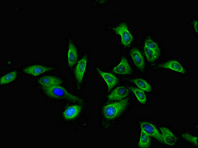 Immunofluorescent analysis of Hela cells using CTSA Antibody at dilution of 1:100 and Alexa Fluor 488-congugated AffiniPure Goat Anti-Rabbit IgG(H+L)Rabbit anti-Human CTSA Polyclonal Antibody