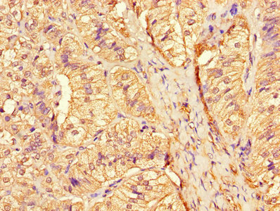 Immunohistochemistry of paraffin-embedded human adrenal gland tissue using the antibody at dilution of 1:100Rabbit anti-Human CTSA Polyclonal Antibody