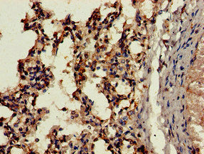 Immunohistochemistry of paraffin-embedded human lung tissue using CTSH Antibody at dilution of 1:100Rabbit anti-Human CTSH Polyclonal Antibody
