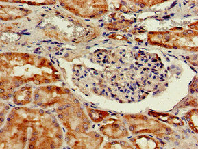 Immunohistochemistry of paraffin-embedded human kidney tissue using CTSH Antibody at dilution of 1:100Rabbit anti-Human CTSH Polyclonal Antibody