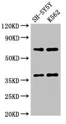 Western Blot  | Positive WB detected in: SH-SY5Y whole cell lysate, K562 whole cell lysate  | All lanes: CTSH antibody at 2.7µg/ml  | Secondary  | Goat polyclonal to rabbit IgG at 1/50000 dilution  | Predicted band size: 38 kDa  | Observed band size: 38 kDaRabbit anti-Human CTSH Polyclonal Antibody