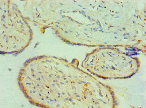 Immunohistochemistry of paraffin-embedded human placenta tissue using CTSK Antibody at dilution of 1:100Rabbit anti-Human CTSK Polyclonal Antibody