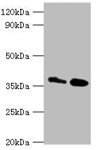 Western blot | All lanes: CTSK antibody at 8μg/ml | Lane 1: MCF-7 whole cell lysate | Lane 2: Rat brain tissue | Secondary | Goat polyclonal to rabbit IgG at 1/10000 dilution | Predicted band size: 37 kDa | Observed band size: 37 kDaRabbit anti-Human CTSK Polyclonal Antibody
