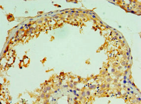 Immunohistochemistry of paraffin-embedded human testis tissue using CTSV Antibody at dilution of 1:100