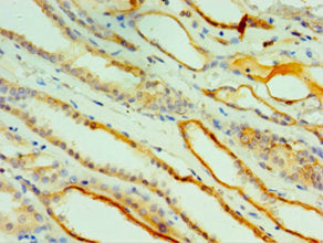Immunohistochemistry of paraffin-embedded human kidney tissue using CTSV Antibody at dilution of 1:100