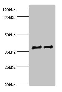 Western blot | All lanes: CTSV antibody at 12μg/ml | Lane 1: Jurkat whole cell lysate | Lane 2: MCF-7 whole cell lysate | Secondary | Goat polyclonal to rabbit IgG at 1/10000 dilution | Predicted band size: 37 kDa | Observed band size: 37 kDa