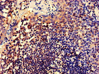 IHC image of CELF2 Antibody diluted at 1:600 and staining in paraffin-embedded human tonsil tissue performed on a Leica BondTM system. After dewaxing and hydration, antigen retrieval was mediated by high pressure in a citrate buffer (pH 6.0). Section was blocked with 10% normal goat serum 30min at RT. Then primary antibody (1% BSA) was incubated at 4°C overnight. The primary is detected by a biotinylated secondary antibody and visualized using an HRP conjugated SP system.