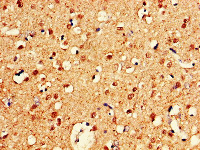 IHC image of CELF2 Antibody diluted at 1:600 and staining in paraffin-embedded human brain tissue performed on a Leica BondTM system. After dewaxing and hydration, antigen retrieval was mediated by high pressure in a citrate buffer (pH 6.0). Section was blocked with 10% normal goat serum 30min at RT. Then primary antibody (1% BSA) was incubated at 4°C overnight. The primary is detected by a biotinylated secondary antibody and visualized using an HRP conjugated SP system.