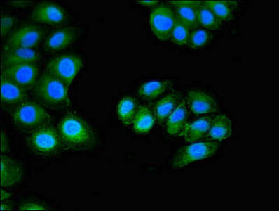 Immunofluorescent analysis of A549 cells using CUTA Antibody at dilution of 1:100 and Alexa Fluor 488-congugated AffiniPure Goat Anti-Rabbit IgG(H+L)Rabbit anti-Human CUTA Polyclonal Antibody